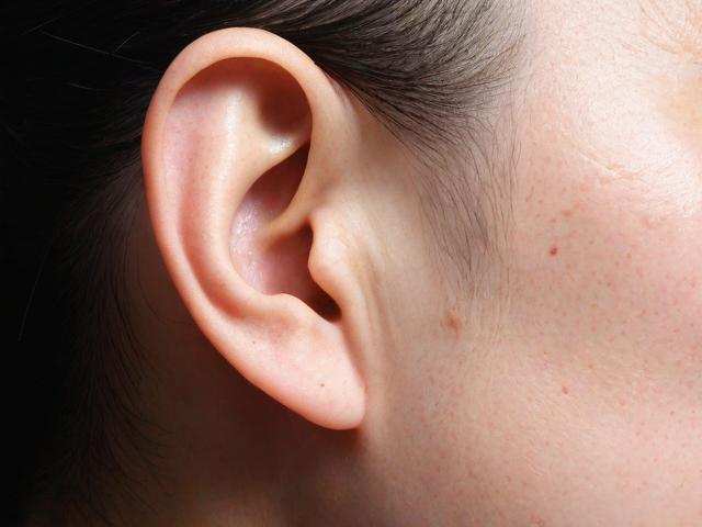 耳边长小肉球是福气?医学上叫“富耳”,无害但与基因有关