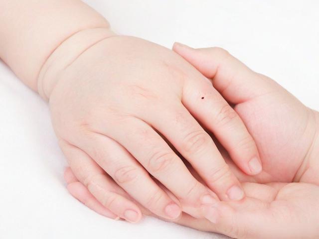 宝宝手上经常出现倒刺?妈妈要注意保湿!