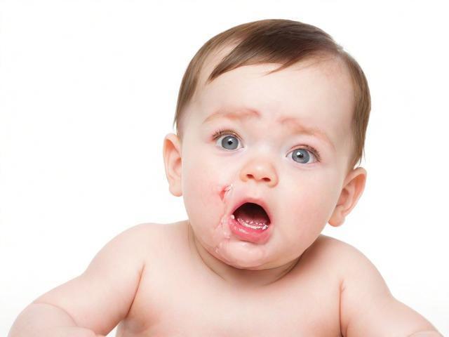 宝宝吐奶严重,两个月大口吐奶原因及解决办法